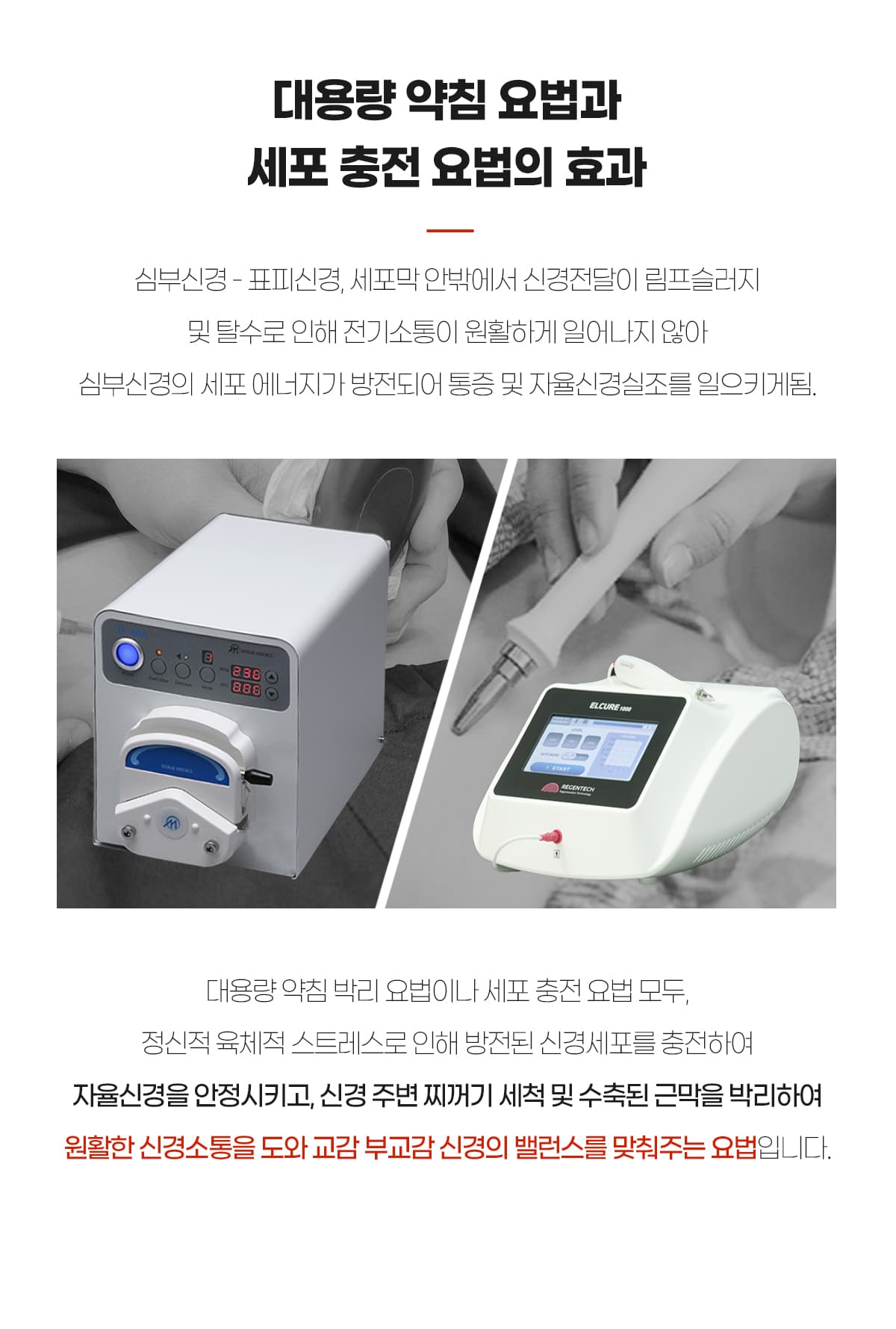 약침박리와 세포충전