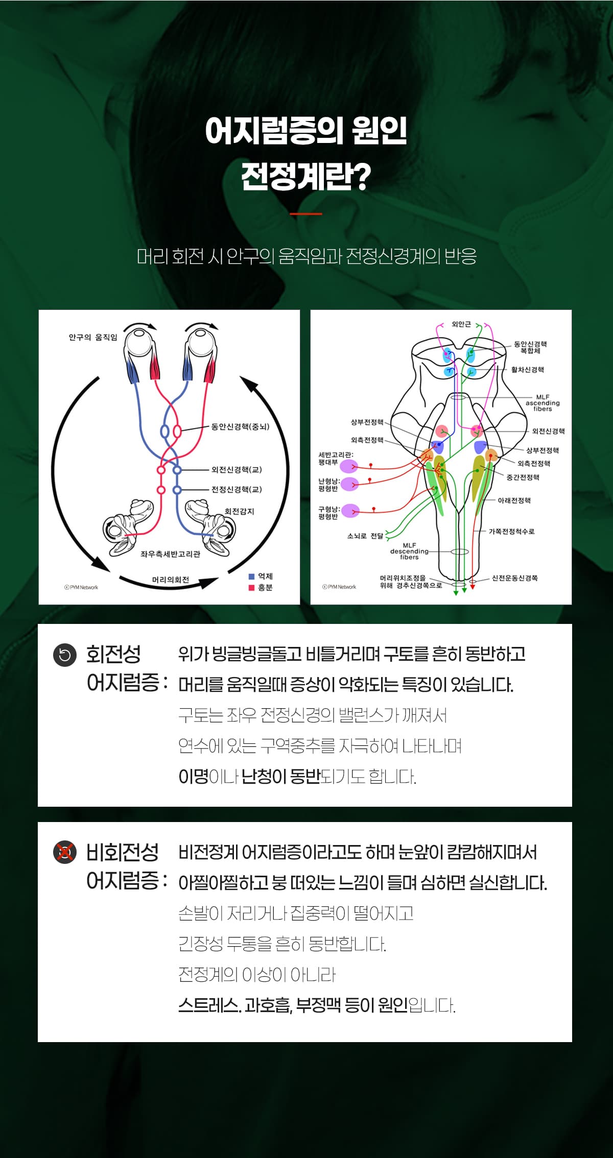 원인-전정계