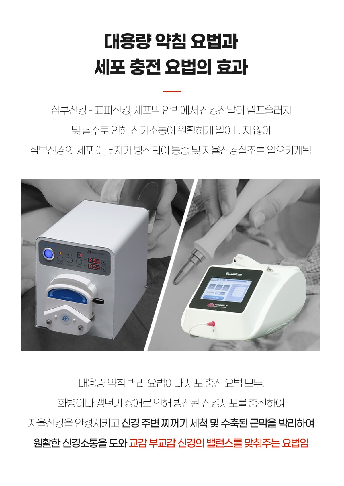 약침박리와 세포충전