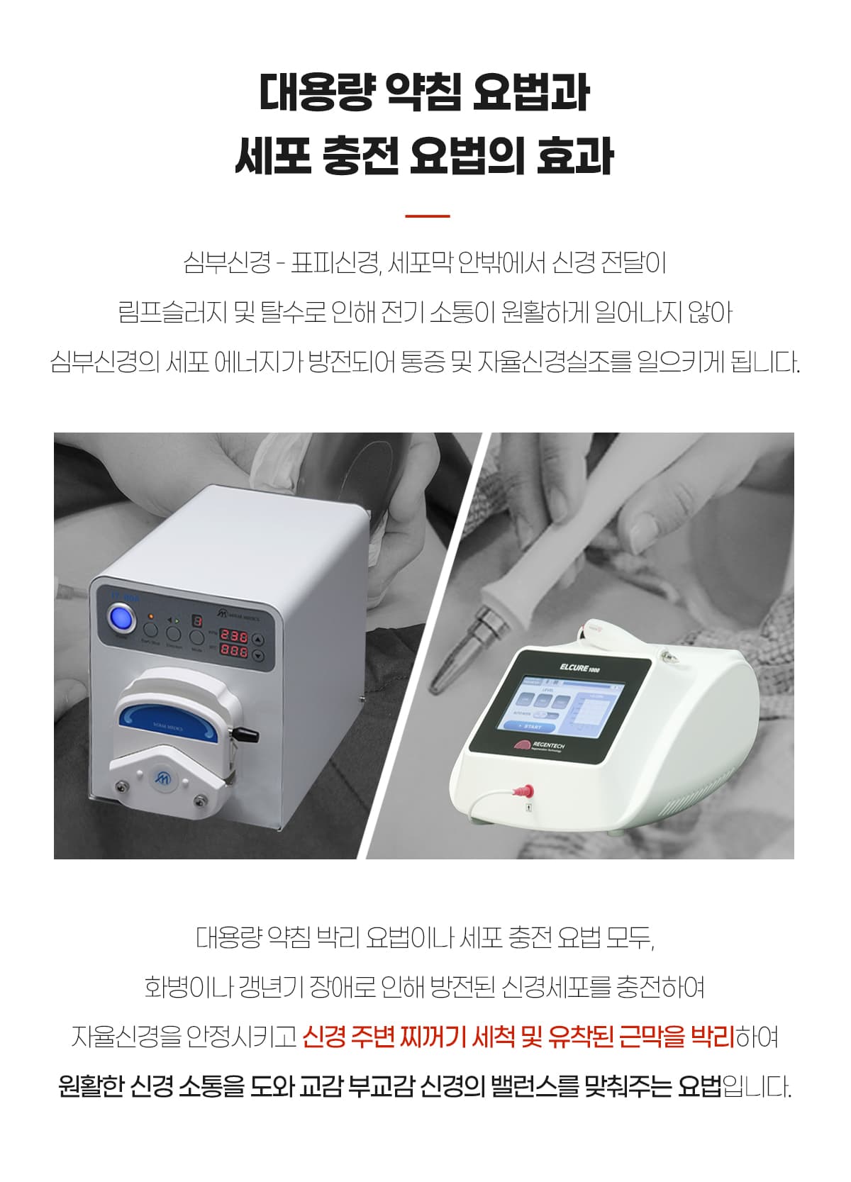 약침박리와 세포충전
