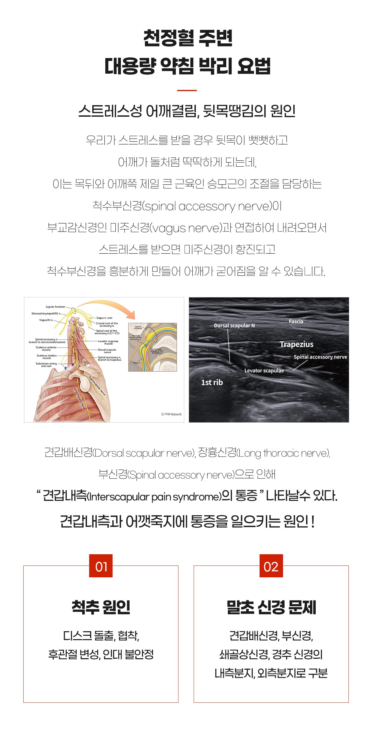 전정혈 약침박리