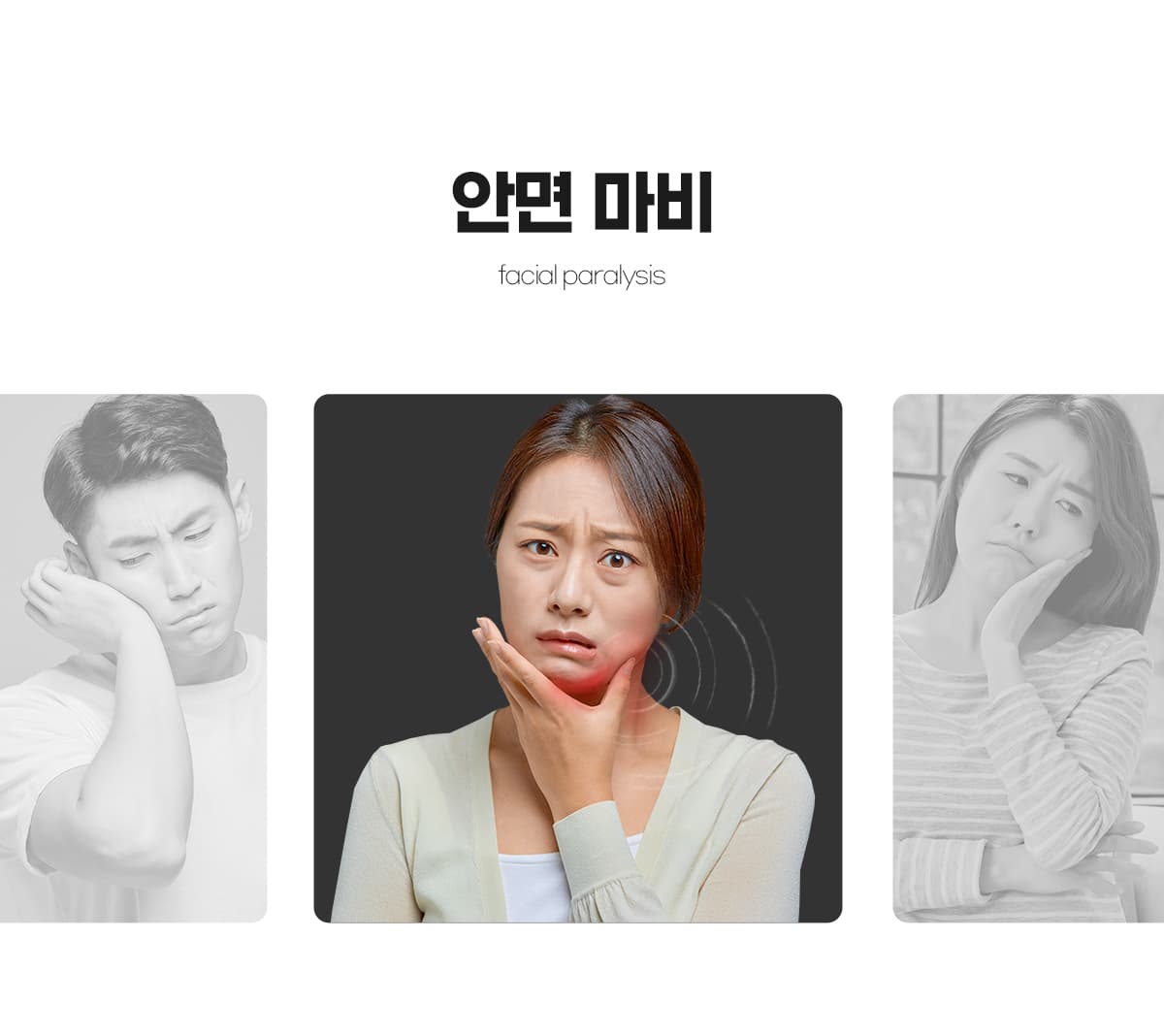 안면마비