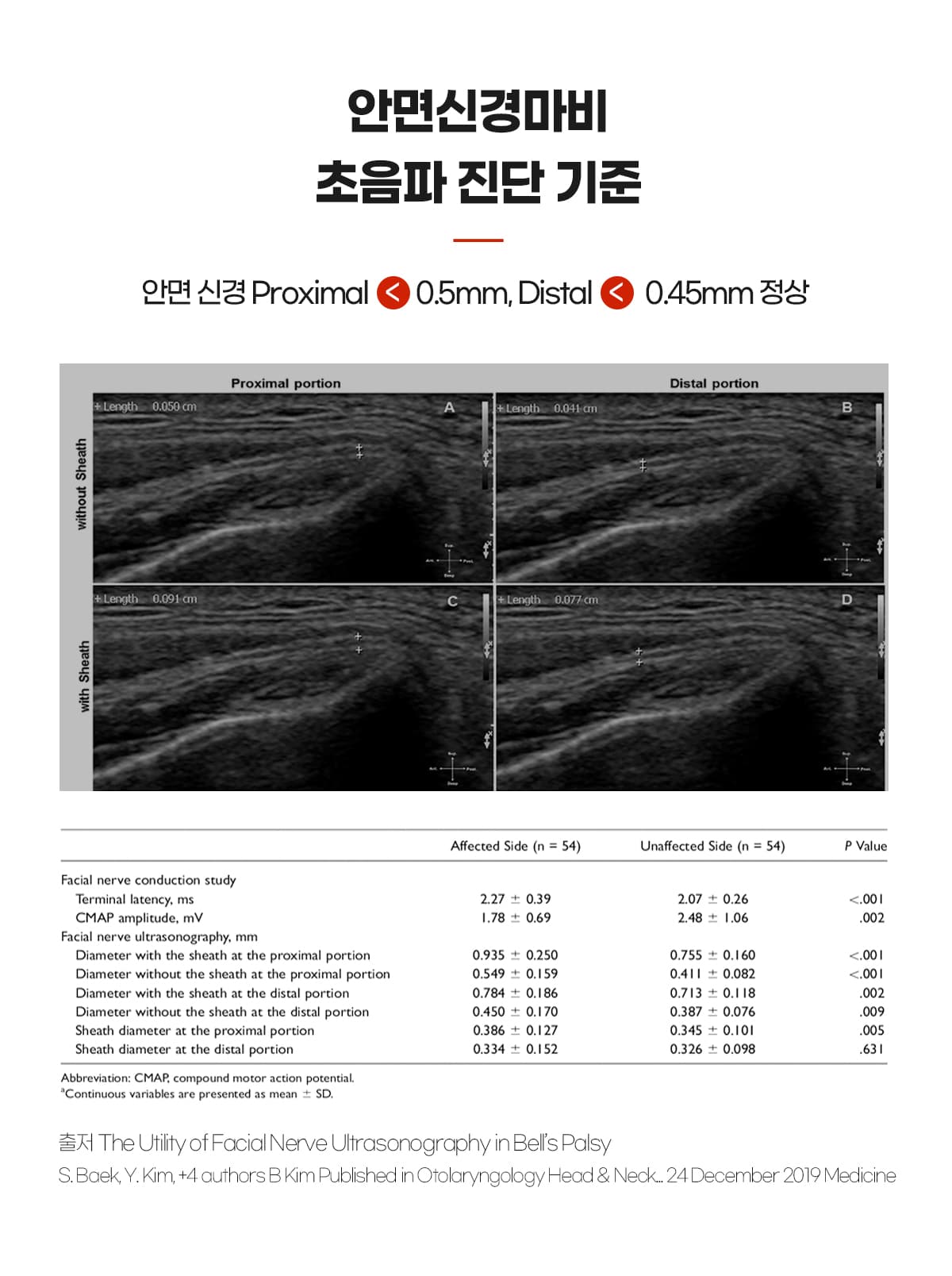 초음파 진단기준