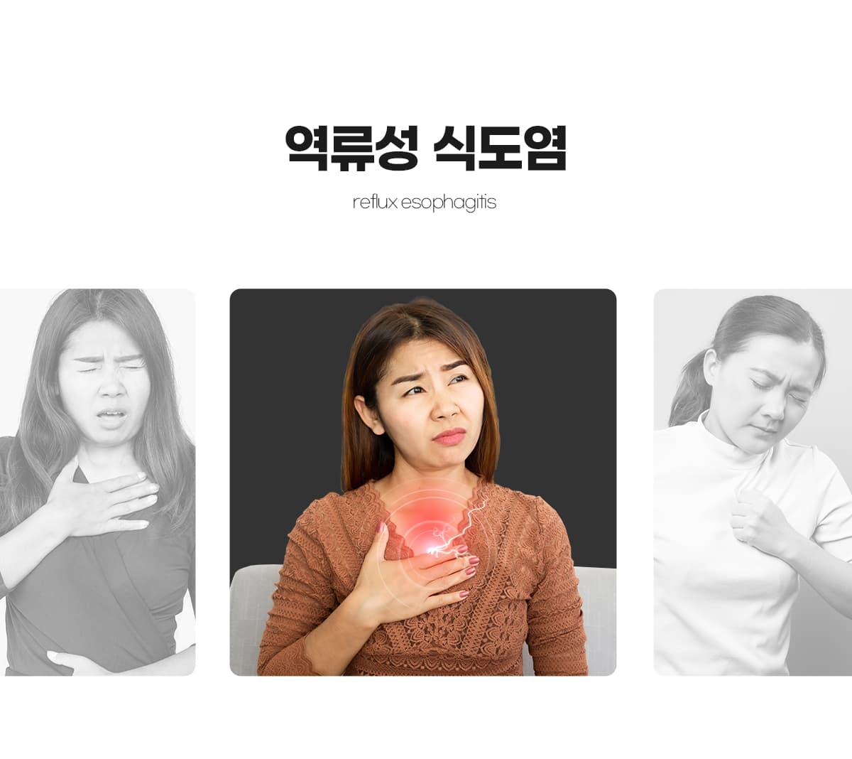 역류성식도염