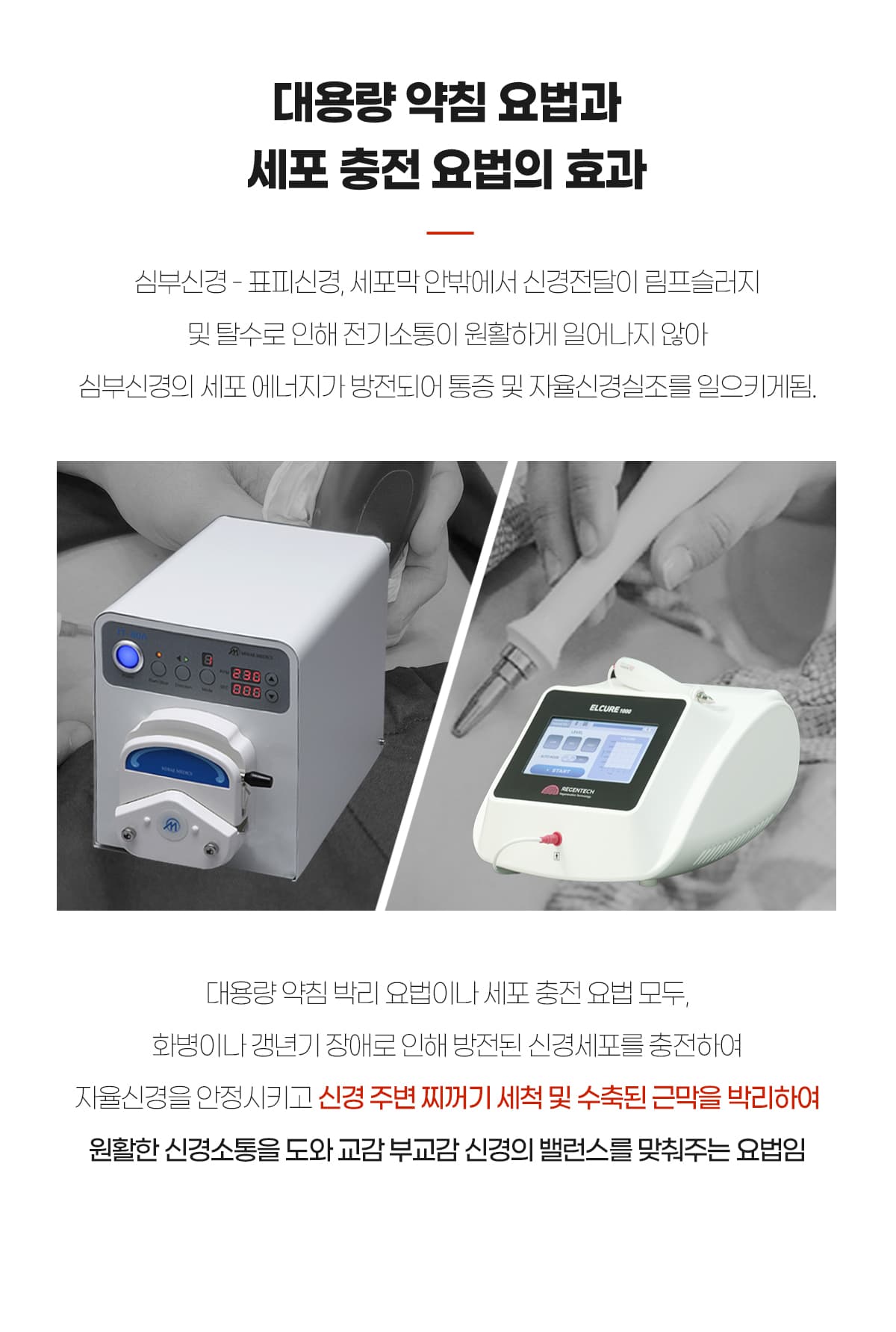 약침박리와 세포충전