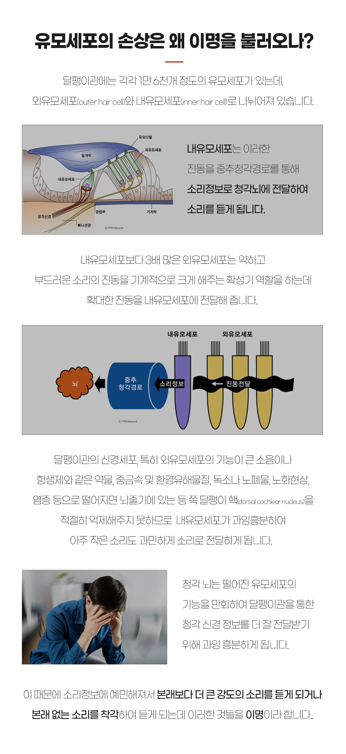 유모세포손상