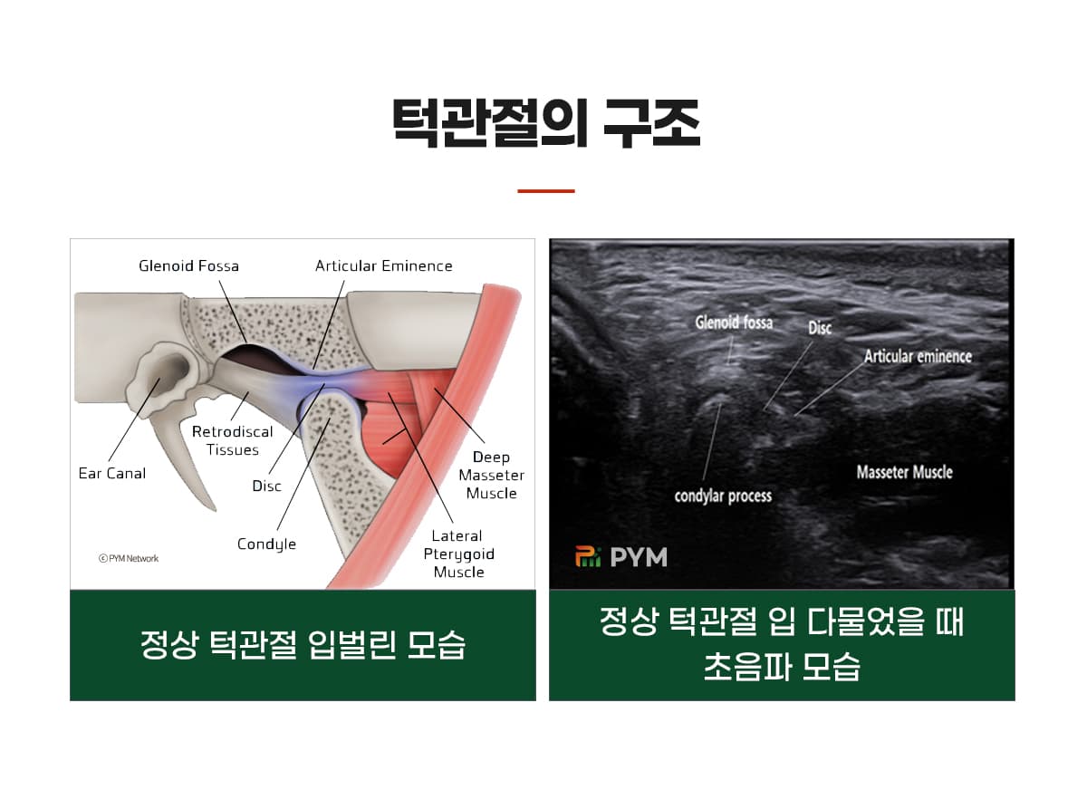 턱관절 구조