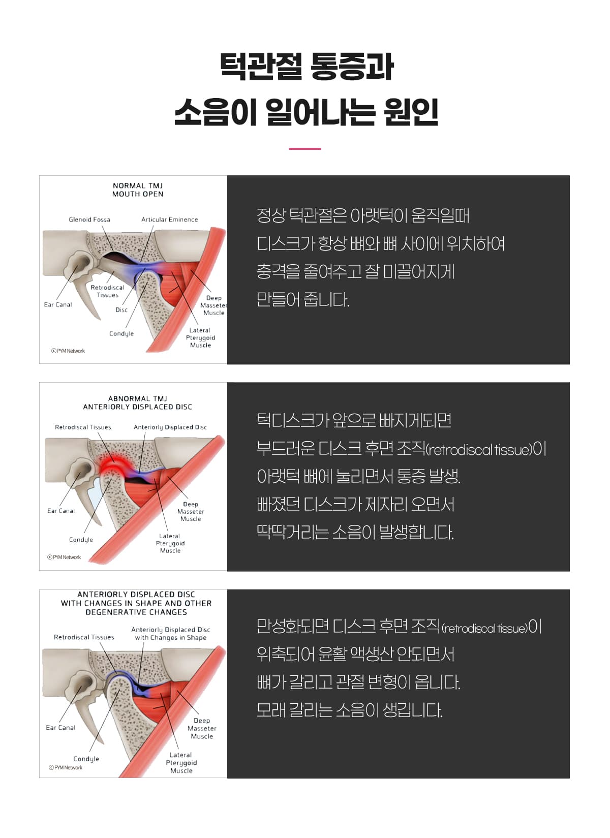 통증과 소음 원인