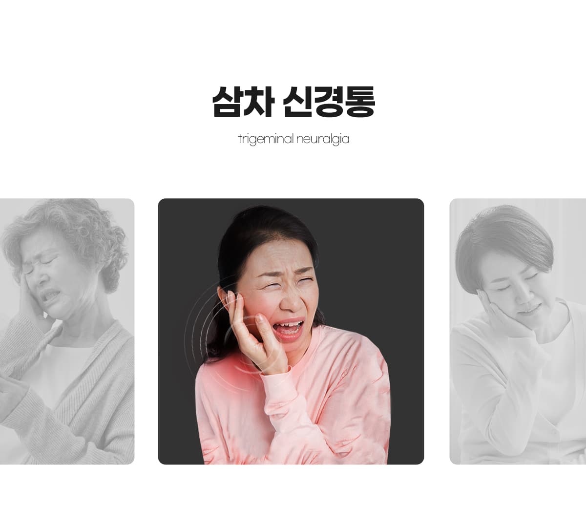 삼차신경통