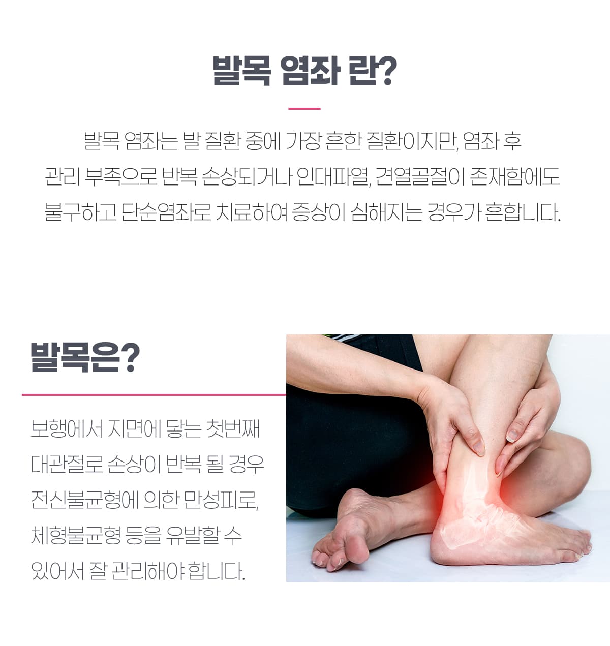 발목 염좌