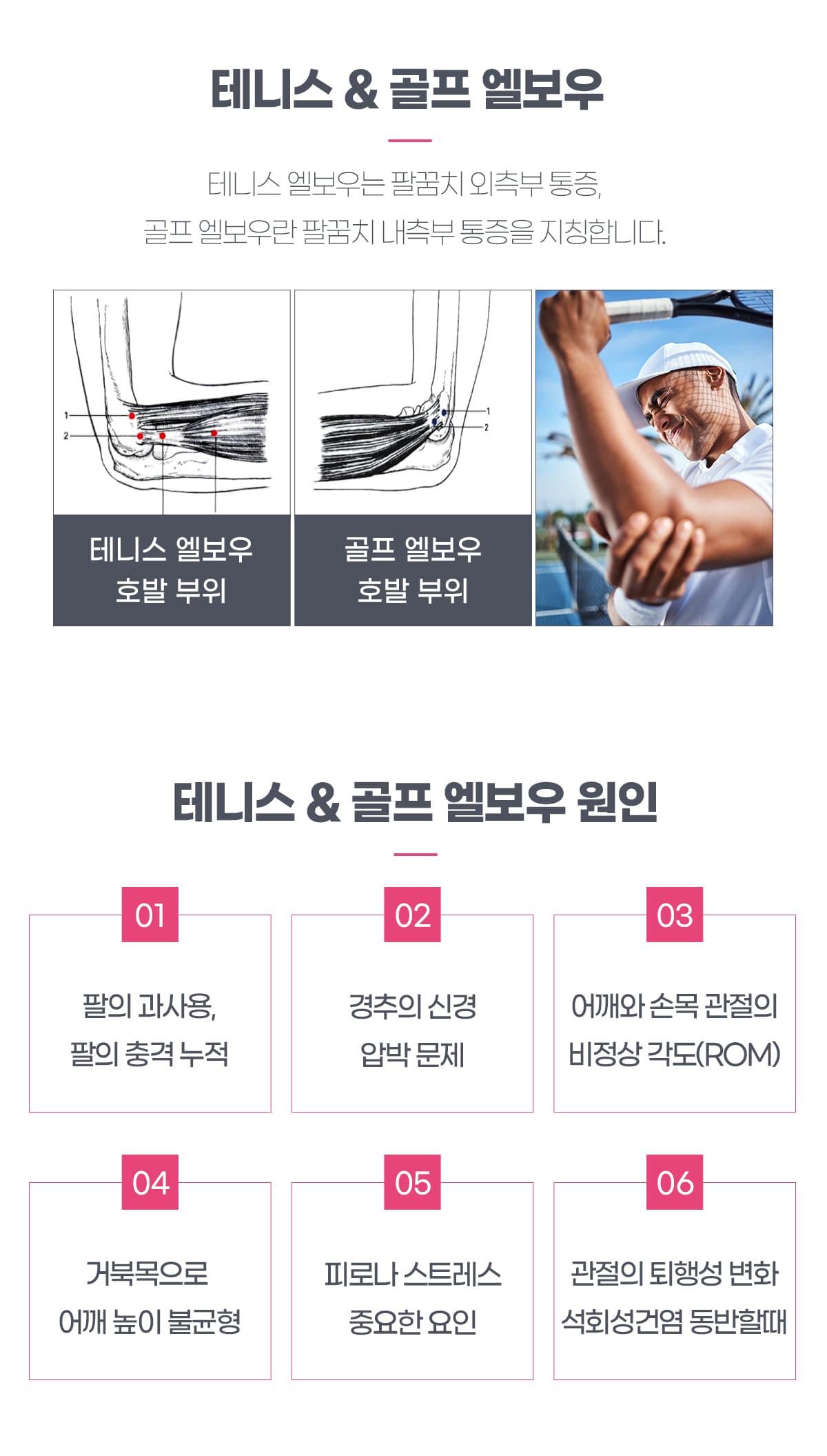 테니스 & 골프 엘보우