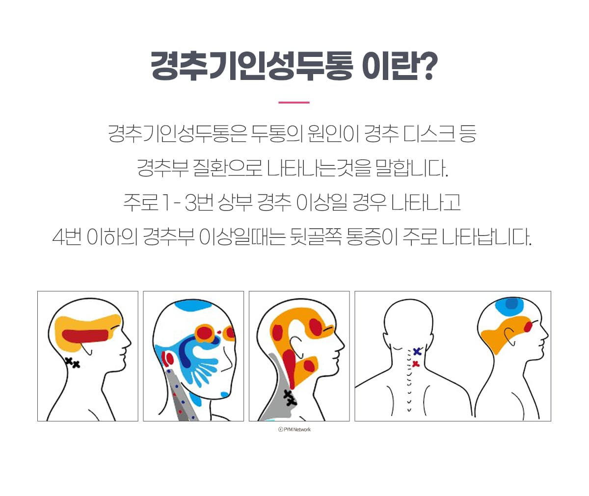 경추 기인성 두통