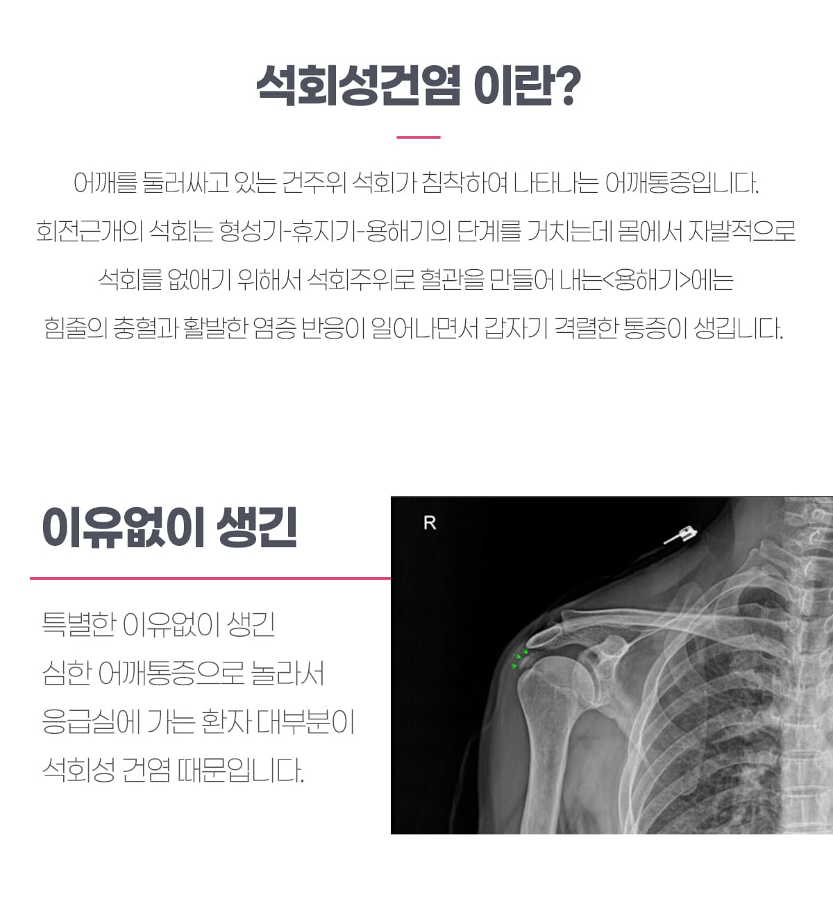 석회성건염