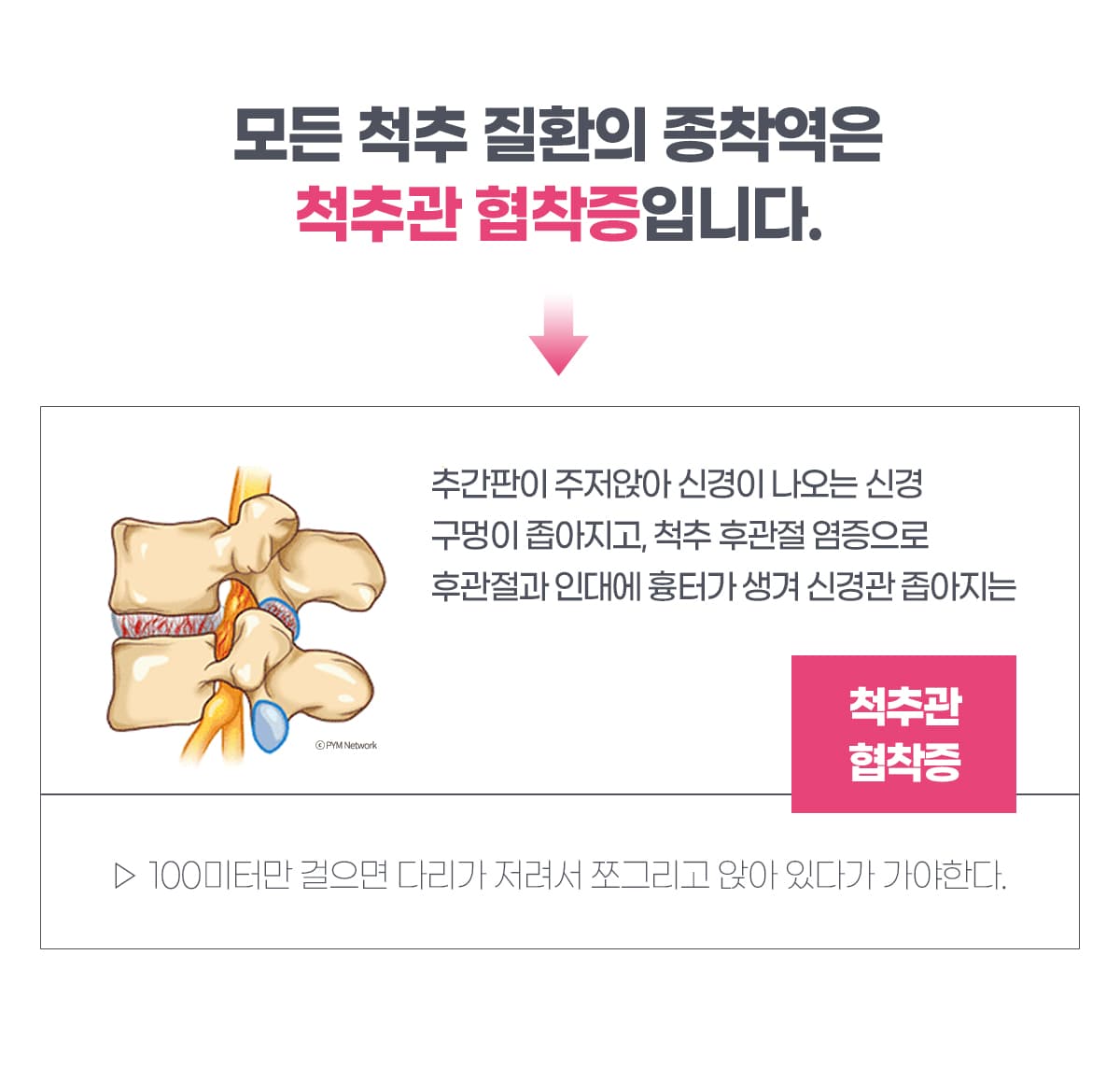 척추질환 종착역