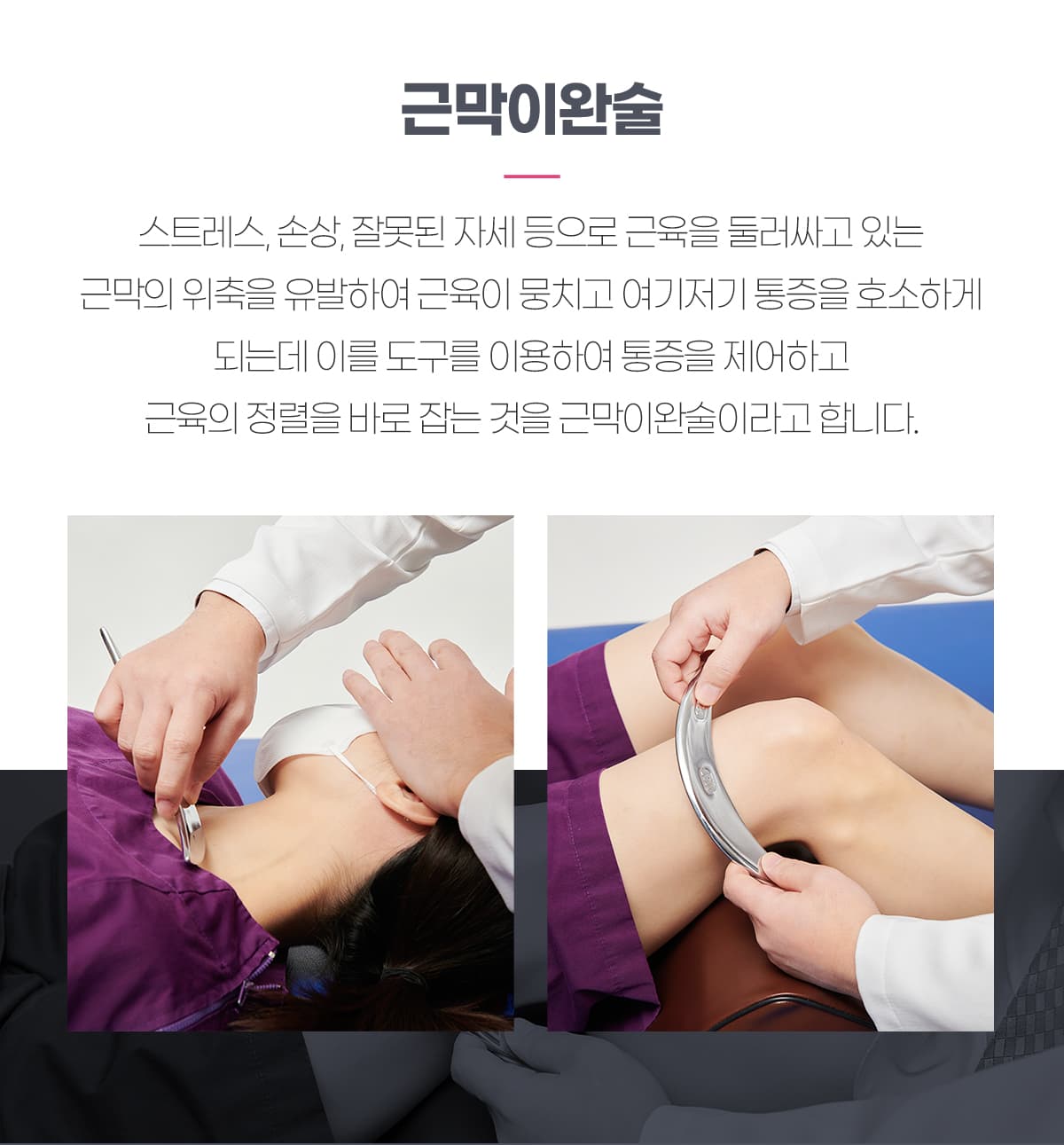근막이완술