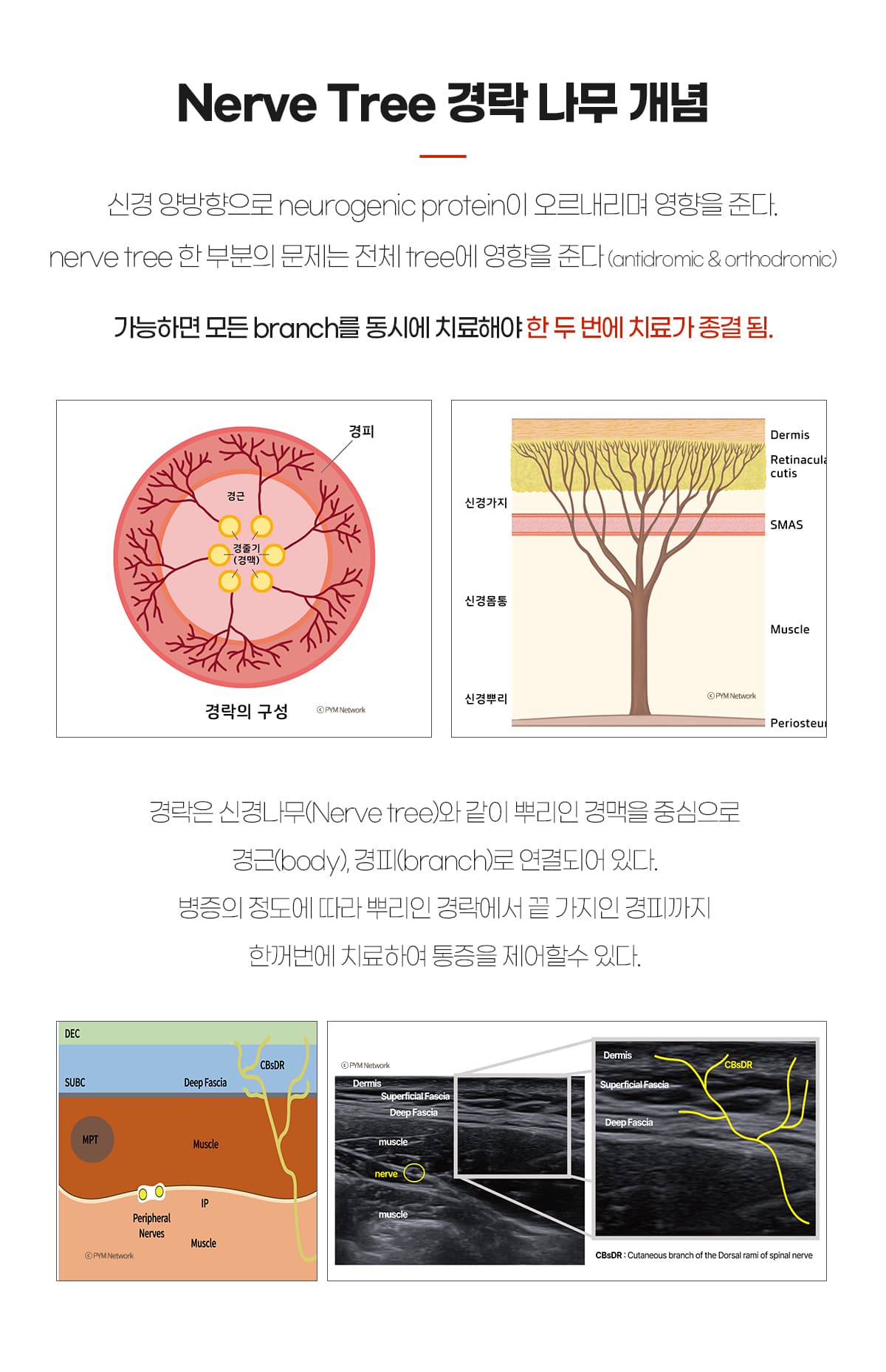 Nerve Tree 경락 나무 개념