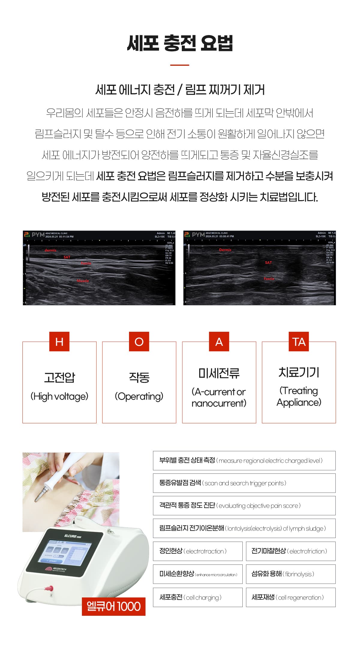 세포충전요법