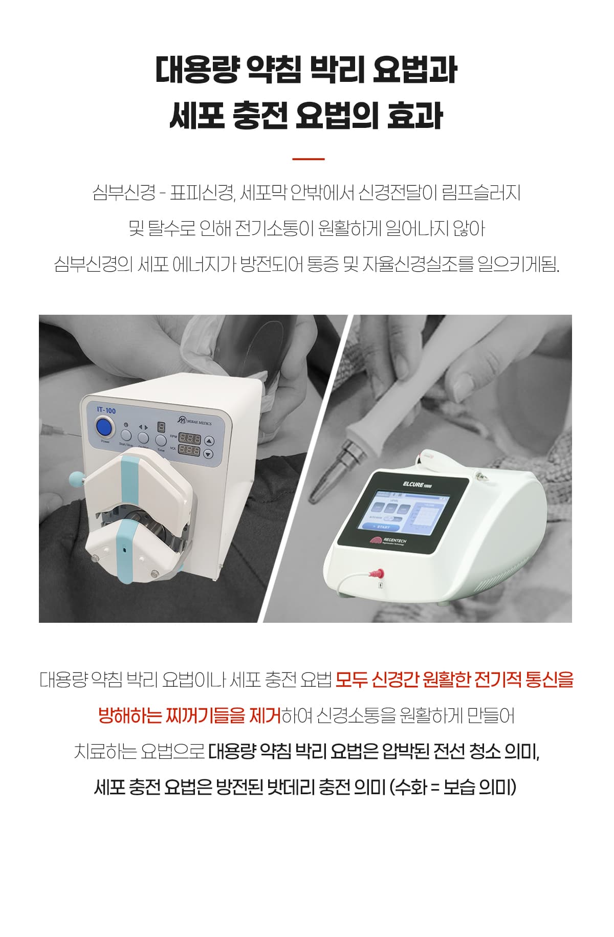 박리요법과 세포충전